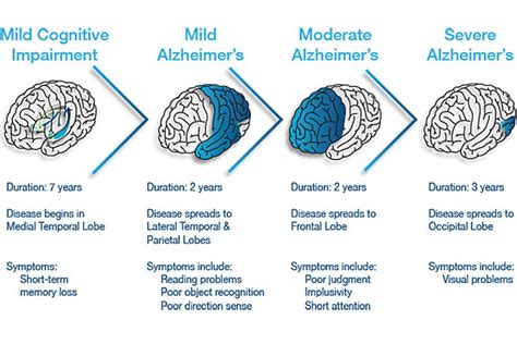 What Are The Three Stages Of Alzheimer S Disease