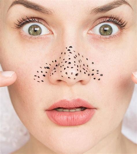 8 Super Simple Tips To Remove Blackheads On Nose Immediately