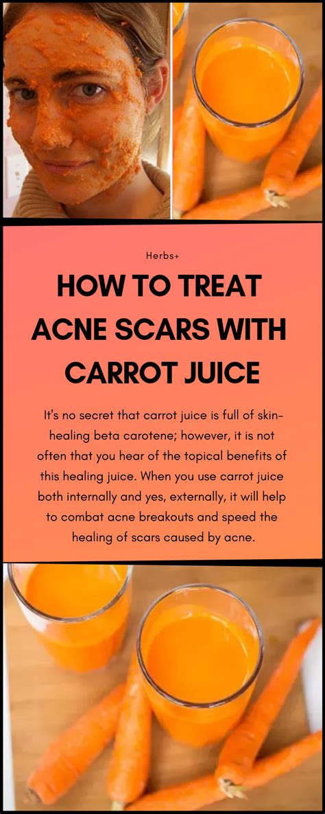 Drinking Carrot Juice For Acne Lema