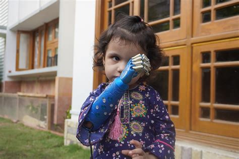 مصنوعی ہاتھ حاصل کرنے والی سب سے کم عمر تین سالہ پاکستانی بچی Independent Urdu