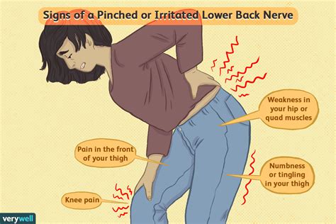 Lower Back Pain Left Side Above Hip Ovulation Symptoms