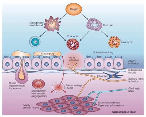 7 Schematic representation of asthma pathophysiology. Several