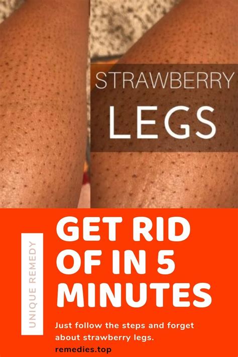 Are You Ready To Get Rid Of Strawberry Legs In Easy Steps