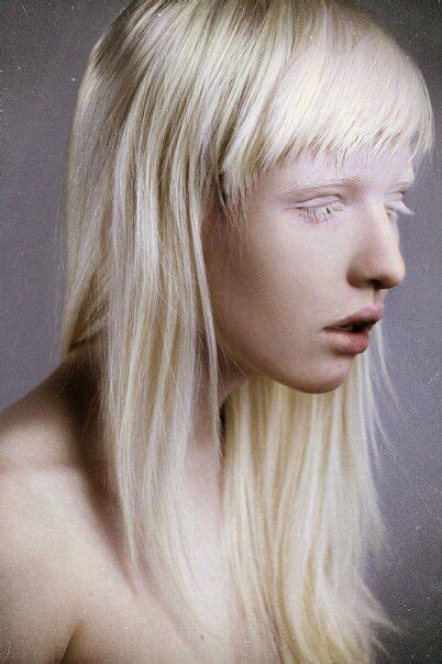 Nastya Zhidkova Side Profile Albino Model Beauty