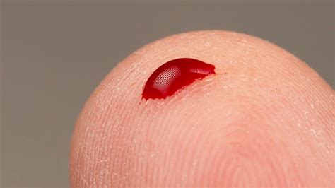 One Drop Of Blood Can Reveal Almost Every Virus A Person Has Ever Had