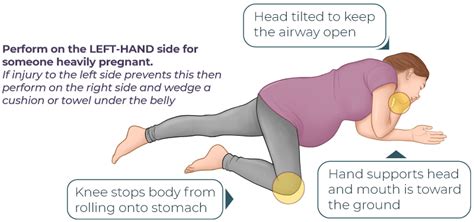 Cpr Pregnancy Step By Step Guide