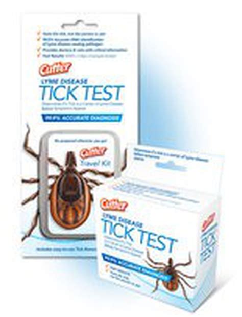 Worried About A Tick Bite Esu Develops Lyme Disease Test To Ease