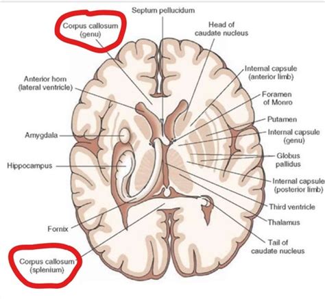 Brain Anatomy Transverse Section Flashcards Quizlet
