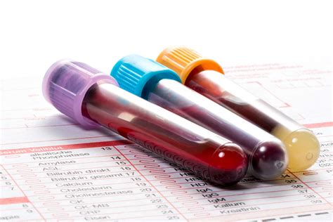 Blood Testing Tubes — Stanford Blood Center
