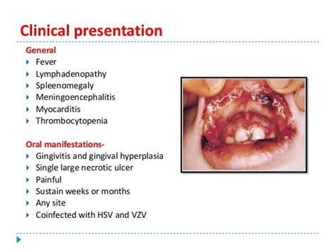 Priya Seminar On Ulcerativevesicular And Bullous Lesions