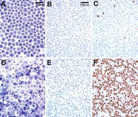 Improved Detection Of Apoptotic Cells In Archival Paraffin Sections Immunohistochemistry Using