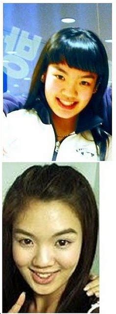 Onlykpop Snsd S Predebute And Plastic Surgery Revealed Pics