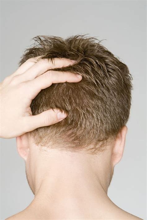 But the question is do both cause hair loss and damage your hair? The Sneaky Things Causing Your Scalp to Itch and Flake ...