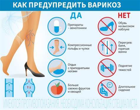 Профилактика варикоза. Советы флеболога. Картинка - Профилактика варикоза. Советы флеболога.