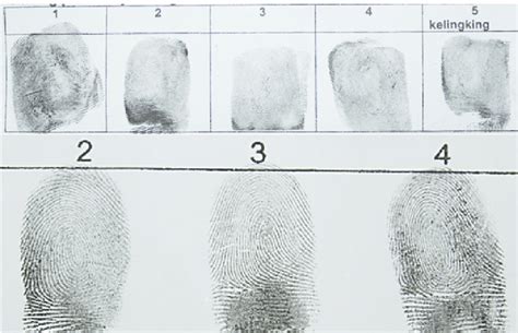 Fingerprint Patterns A Fingerprint Of Right Hand 1 Thumb Loop