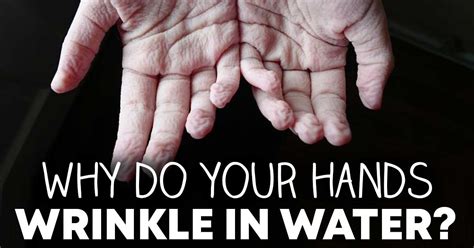 Why Do Your Hands Wrinkle In Water Williams Integracare Clinic