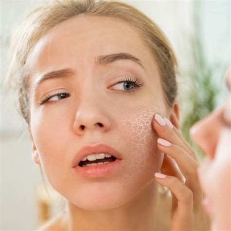 Does Dry Skin Cause Wrinkles Skin Elite