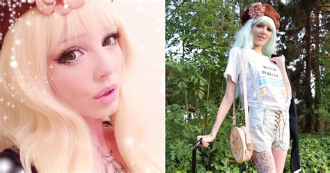 Meet The Human Barbie Whose Genetic Condition Means She S Like A Real