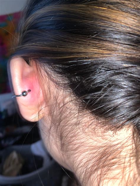 New Conch Piercing On My Ear Does It Look Infected Its Sore And Tender In The Back So I