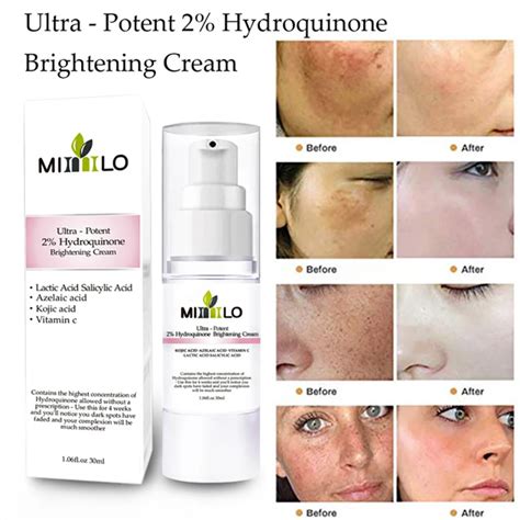 Ultra Potent 2 Hydroquinone Brightening Cream Propylene Glycol Kojic