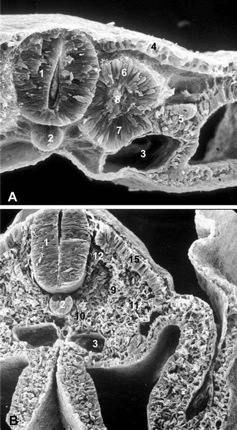 We did not find results for: Amniote somite derivatives - Christ - 2007 - Developmental ...