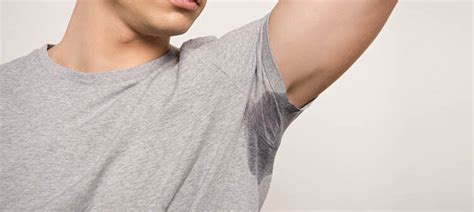 Excessive Sweating Hyperhidrosis Causes And Treatments Karidis