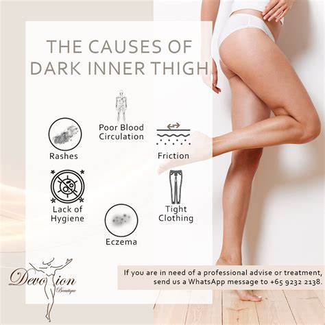 dark spots inner thighs treatment