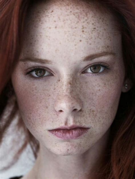 yesgingerfriend “klasse sommersprossen ” beautiful freckles freckles girl freckles