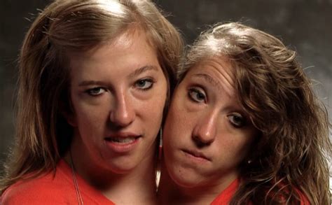 Conjoined Twins Abby And Brittany Hensel Where Are They Now News