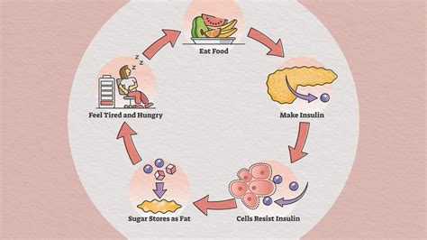 Insulin Resistance Causes Symptoms Diagnosis And Consequences