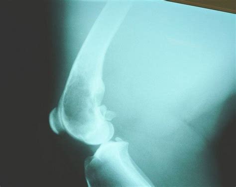 Signs Of Osteosarcoma Bone Cancer In Dogs Pethelpful