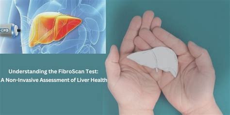 Understanding The Fibroscan Test A Non Invasive Assessment Of Liver