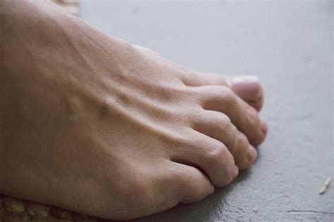Signos De Artritis En Los Pies Foot And Ankle Group Abc Patient