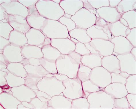 Biologizing Using Stem Cells Derived From Adipose Tissue To Regenerate