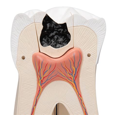 Anatomical Teaching Models Plastic Human Dental Models Giant Molar