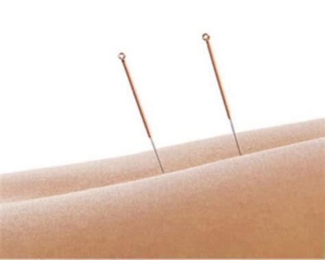 regular treatment — rapha acupuncture and herbs