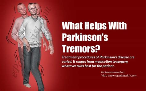 What Helps With Parkinson S Tremors ParkinsonsInfoClub Com