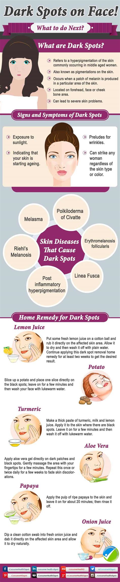 Dark Spots On Face Causes And Treatments 2022