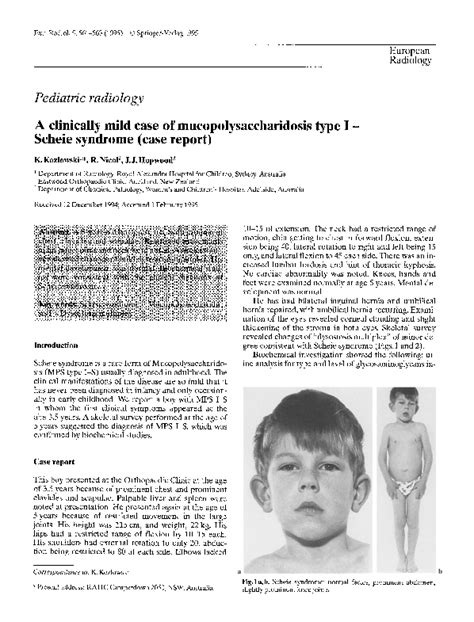 pdf a clinically mild case of mucopolysaccharidosis type i scheie syndrome case report