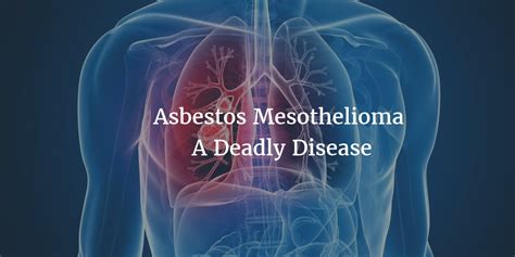 Asbestos Mesothelioma A Deadly Disease About All Mesothelioma