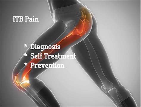 Diagnose And Cure Your Itb Pain The Body Mechanic
