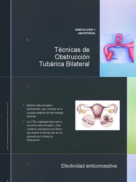 Técnicas De Obstrucción Tubárica Bilateral Ginecologia Y Obstetricia