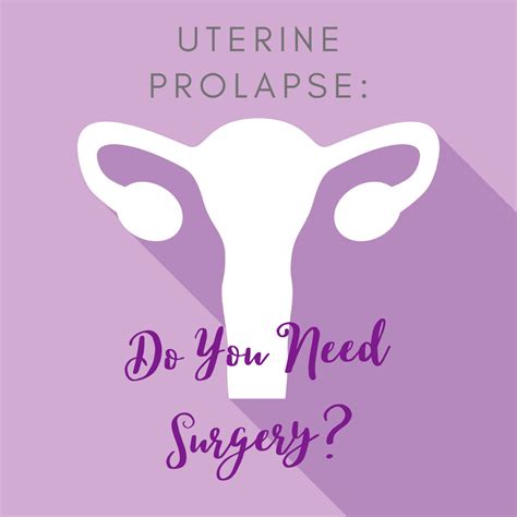 This is due to the general requirement of a 12 month waiting period which needs to be served before you can. Uterine Prolapse: Do You Need Surgery? - Sunshine State Women's Care, LLC