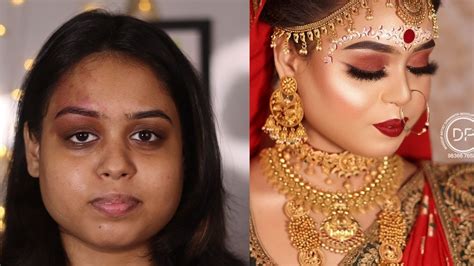 How To Get Rid Of Birthmarks With Makeup Best Bengali Bridal Look