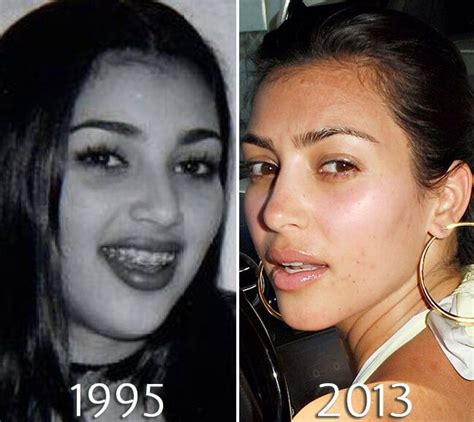 Kim Kardashian Nosejob Before And After Kardashian Plastic Surgery