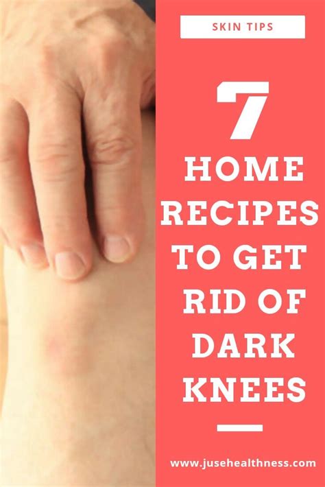 7 Home Recipes To Get Rid Of Dark Knees Darkknees