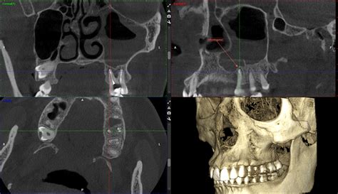 Cbct X Ray Images Dentist In Leeds