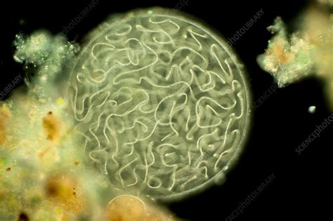 Nostoc Cyanobacteria Light Micrograph Stock Image C0349854
