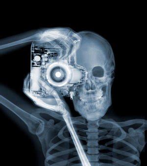 fascynujące zdjęcia rentgenowskie Nicka Veasey a Swiatobrazu pl