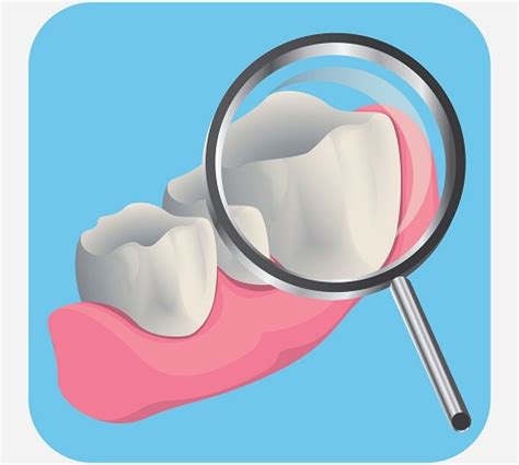 Gingival Abscess Prevention And Treatment